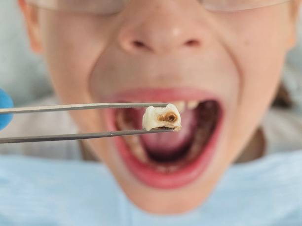 Best Urgent Dental Care for Toothache in Cerro Gordo, IL