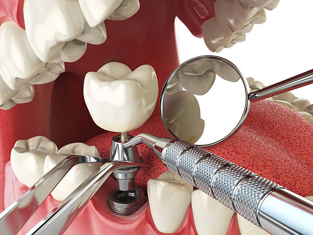 Best Emergency Cosmetic Dentistry in Cerro Gordo, IL